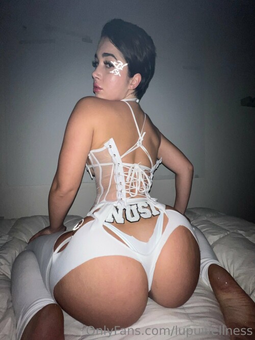 Liz | Lupuwellness Nude Leaked Onlyfans Photo